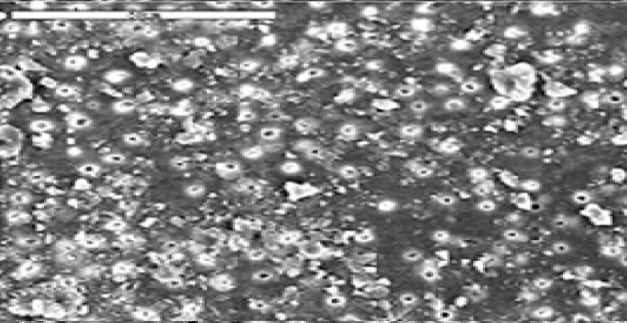 untreated root canal walls