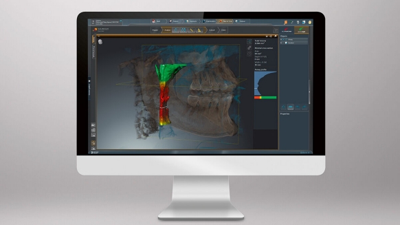 3D Dental X-Ray