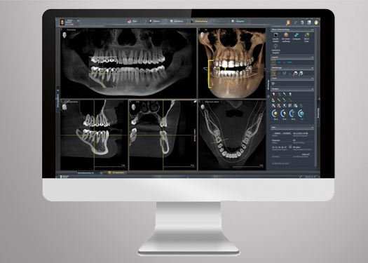 Orthophos Digital Dental X-Ray Machine