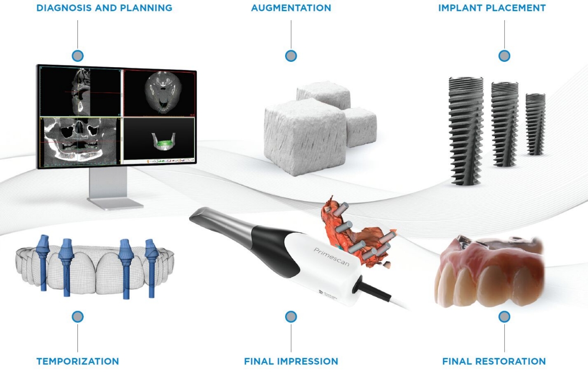 Astra Tech Implant EV
