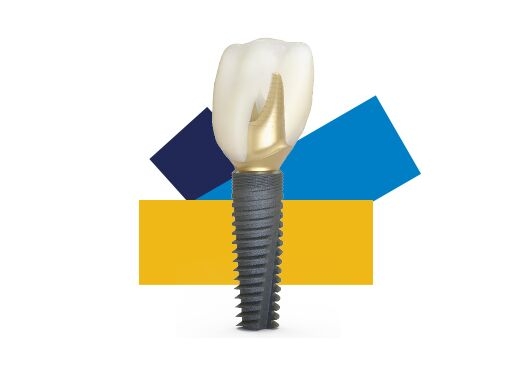 Dentsply Sirona Implants - PrimeTaper