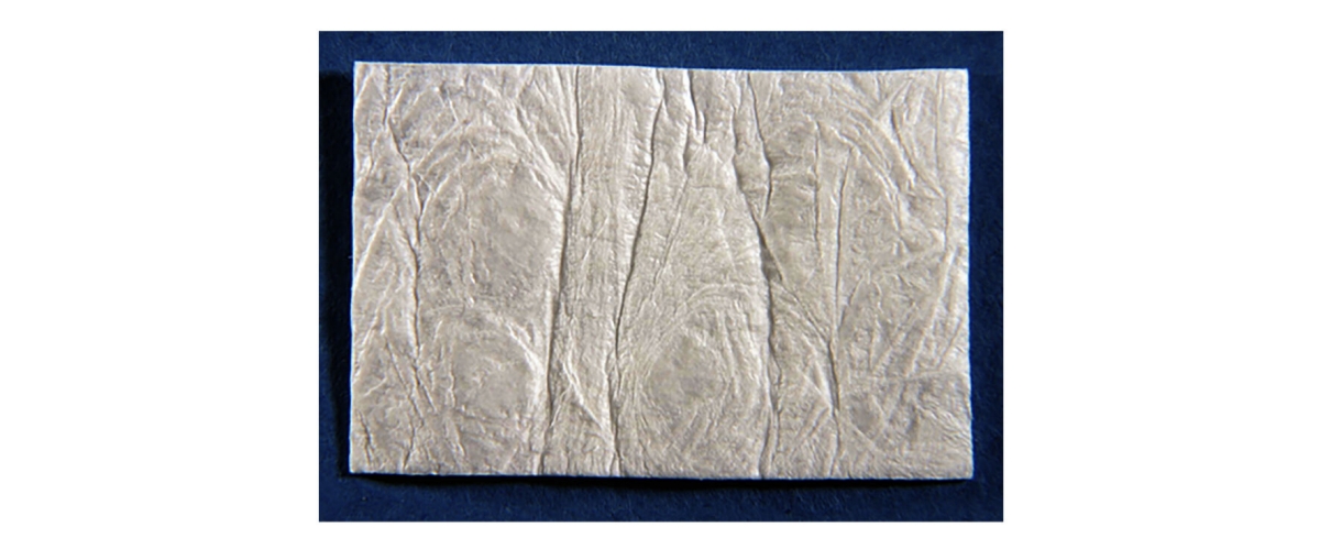 Symbios OsteoShield Collagen Resorbable Membrane