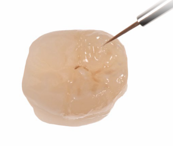dental lab crown and bridge