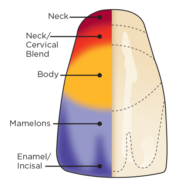 Dentsply Sirona Portrait IPN Denture Teeth Characteristics 