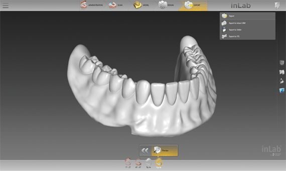 Digital Denture Technology Software