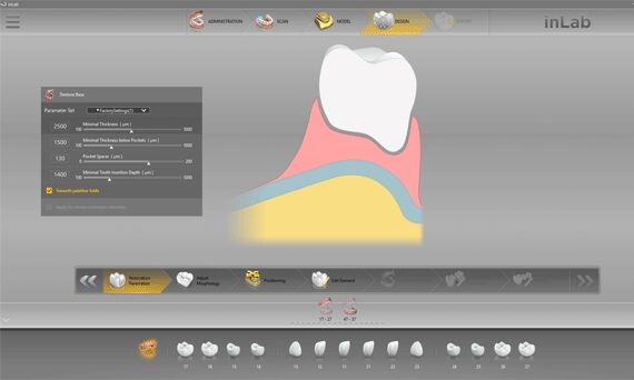 inLab Digital Denture Software