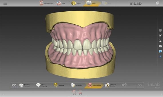 Digital Denture Software