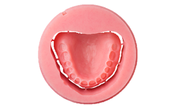 milled denture base