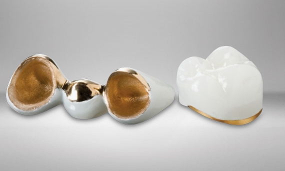 Ceramco 3 metal veneering porcelain