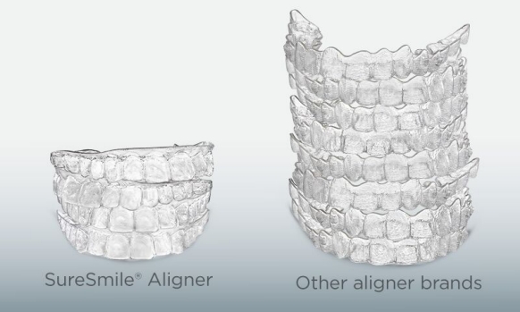 SureSmile Clear Aligner refinements versus other aligner brands