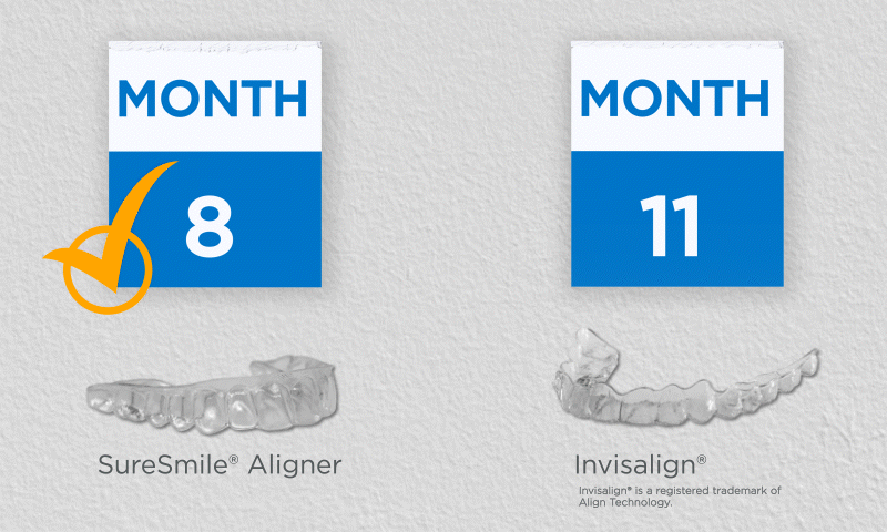 SureSmile vs Invisalign treatment time