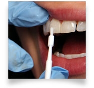 Fluoride Varnish