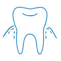 Gingivitis