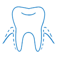 Severe Periodontitis