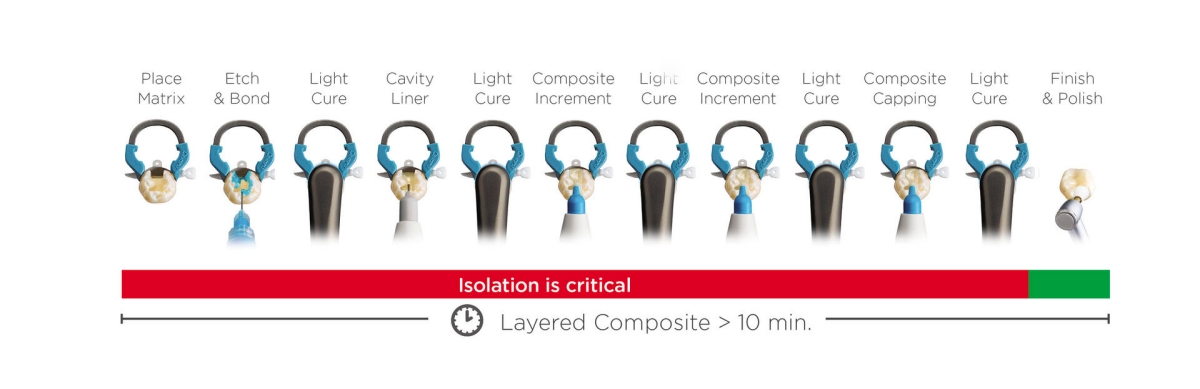 Surefil one – Class II Workflow showing contamination risk