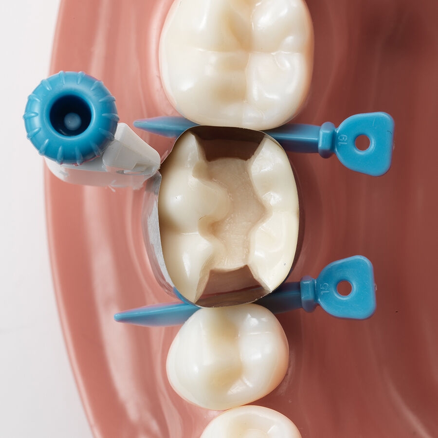 placement option of circumferential dental matrix