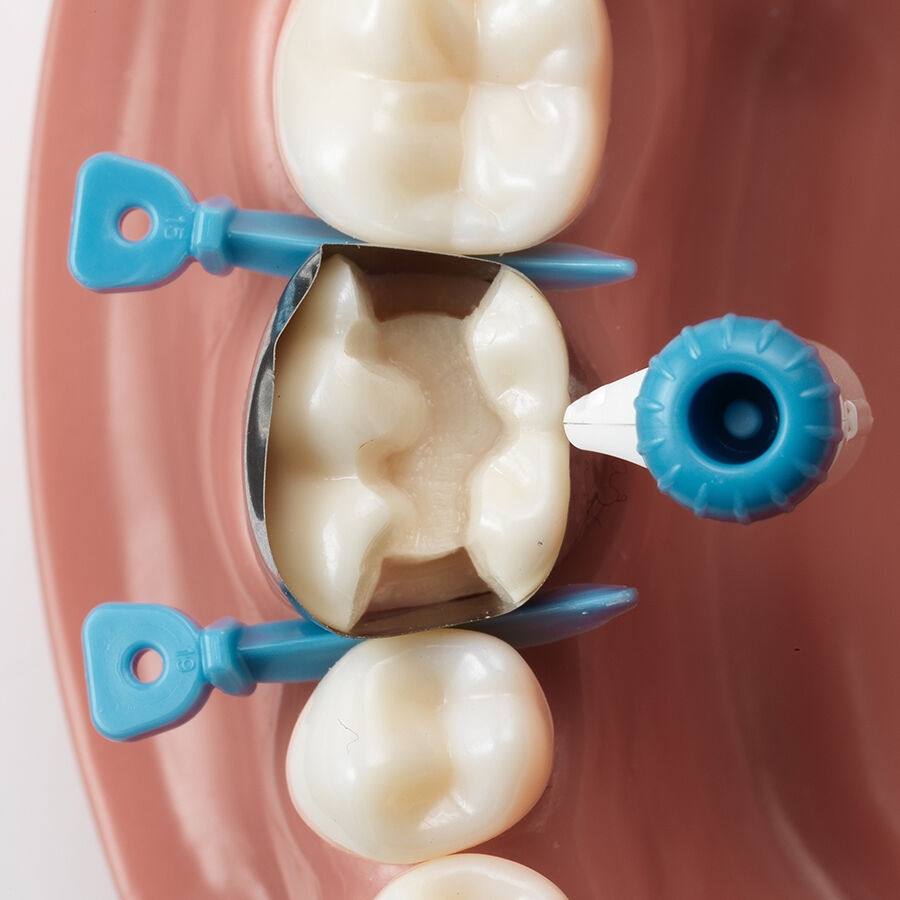 placement option of circumferential dental matrix