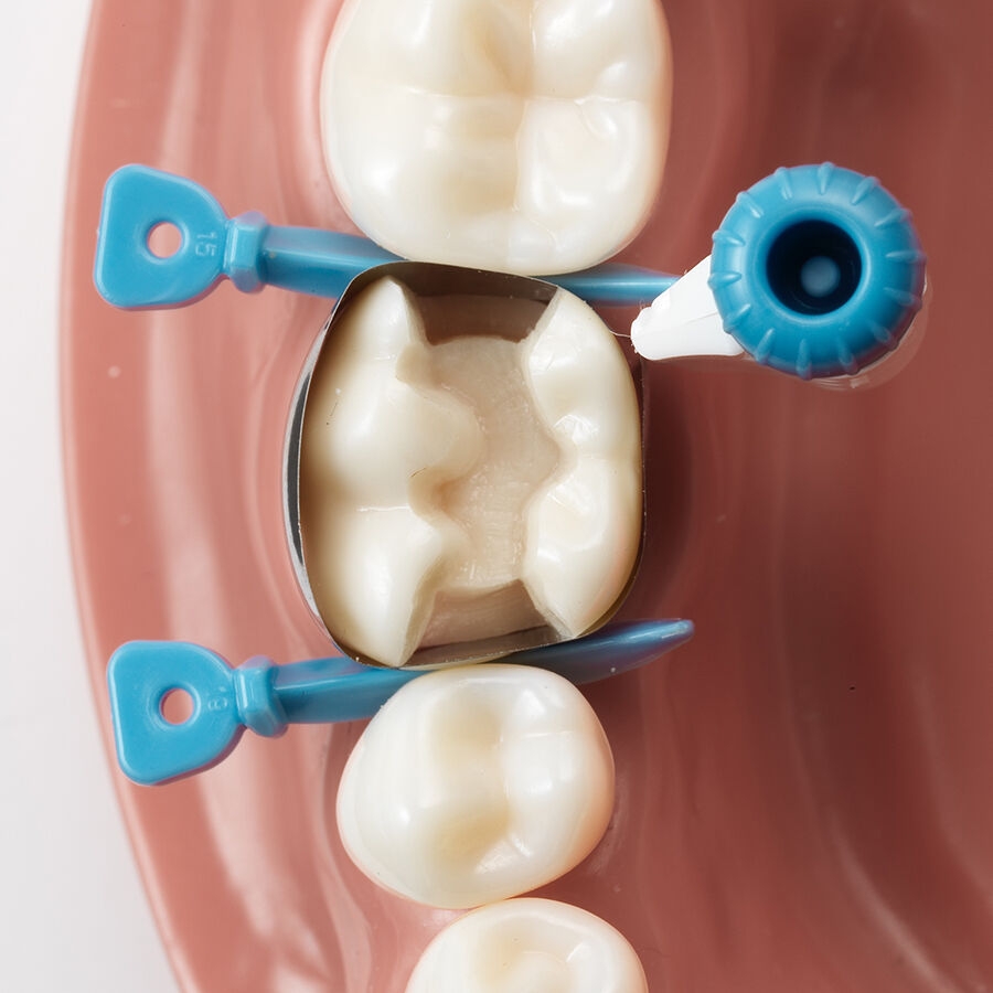 placement option of circumferential dental matrix