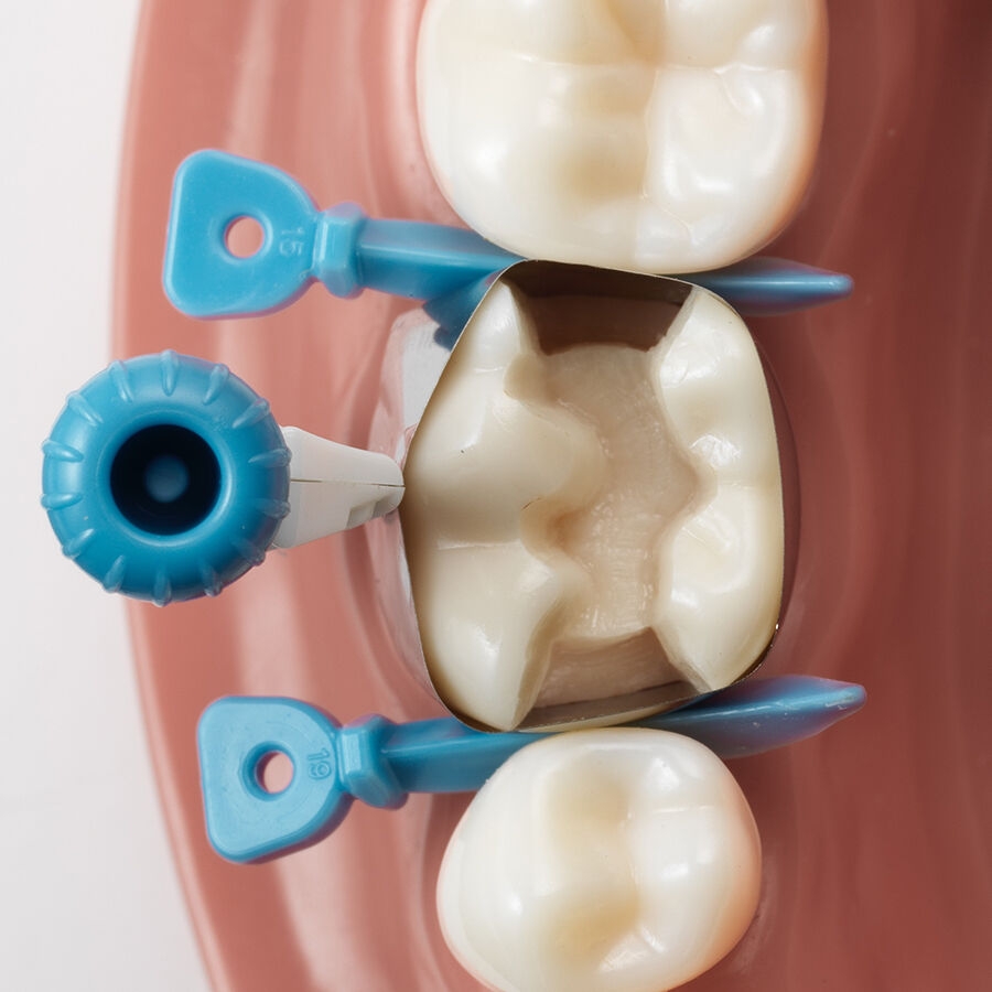 placement option of circumferential dental matrix