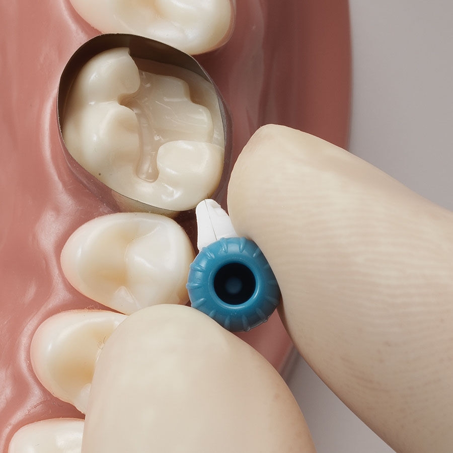 twisting circumferential dental matrix