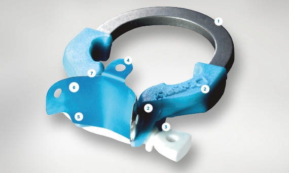 Palodent Plus Benefits with Class II Restorations